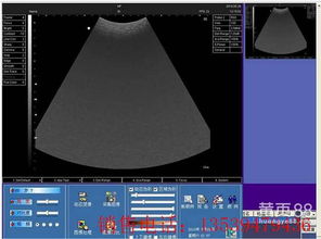 影像工作站报价、厂家与软件开发综合分析